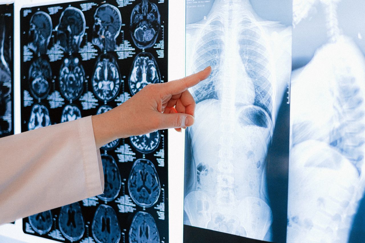 Accueil A doctor pointing at a chest X-ray among MRI scans in a medical clinic.